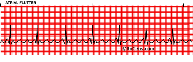 graphic