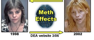 What are the harmful side effects of using meth?